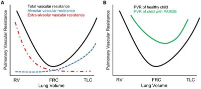 Cardiac dysfunction in severe pediatric acute respiratory distress syndrome: the right ventricle in search of the right therapy